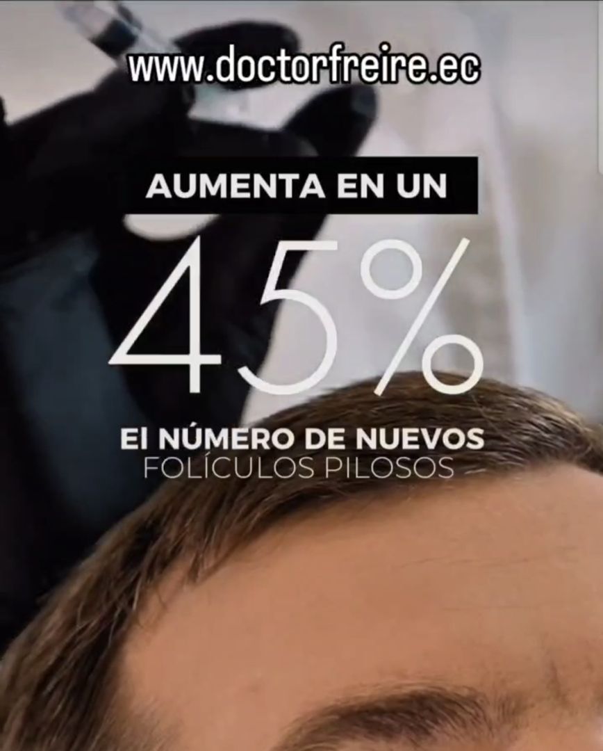 Bioestimulación capilar antes y después